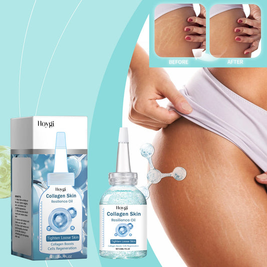 The Efficacy of  Hyaluronic Acid and Tocopherol in Fading Stretch Marks and Restoring Skin